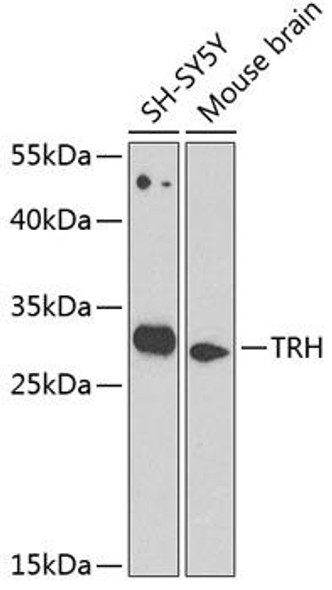 Cell Biology Antibodies 12 Anti-TRH Antibody CAB8322