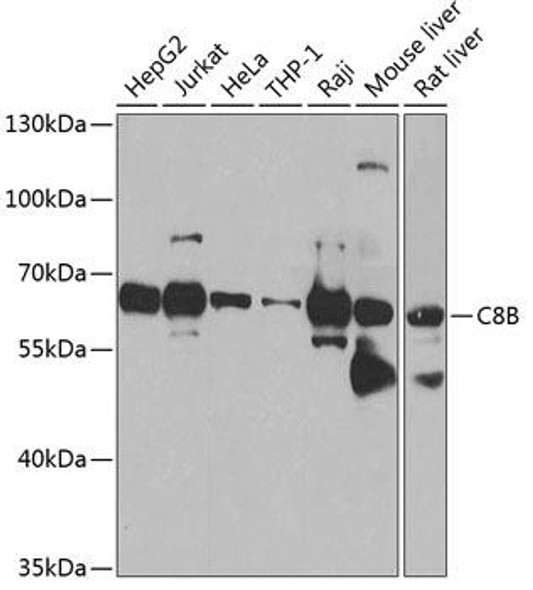 Immunology Antibodies 3 Anti-C8B Antibody CAB8324