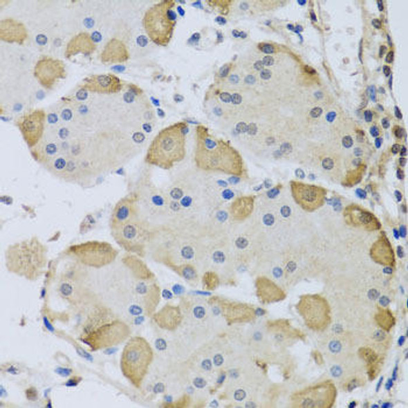 Cell Cycle Antibodies 2 Anti-ANAPC10 Antibody CAB8330