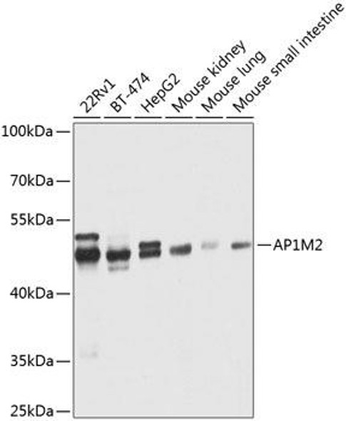 Cell Biology Antibodies 12 Anti-AP1M2 Antibody CAB8331