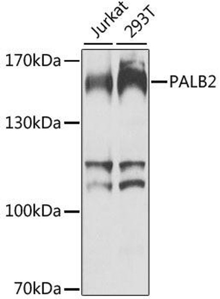 Epigenetics and Nuclear Signaling Antibodies 4 Anti-PALB2 Antibody CAB8373