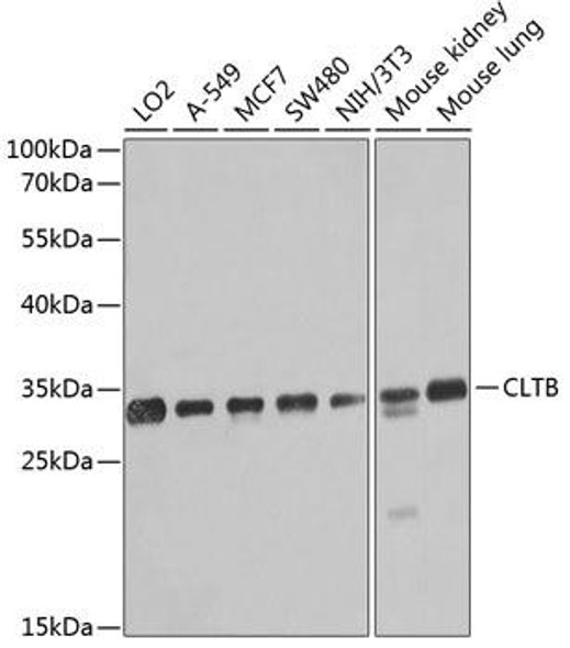 Cell Biology Antibodies 12 Anti-CLTB Antibody CAB8404
