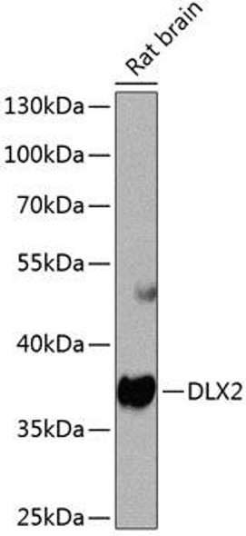 Developmental Biology Anti-DLX2 Antibody CAB8410