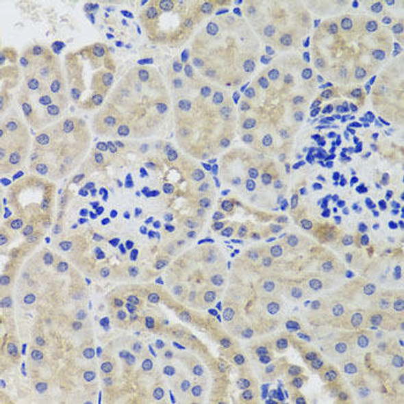 Metabolism Antibodies 3 Anti-Hexokinase-3 Antibody CAB8428