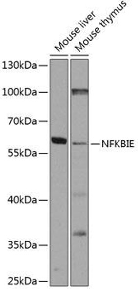 Cell Biology Antibodies 12 Anti-NFKBIE Antibody CAB8443