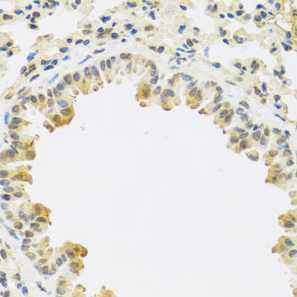 Cell Biology Antibodies 12 Anti-TGFB3 Antibody CAB8460