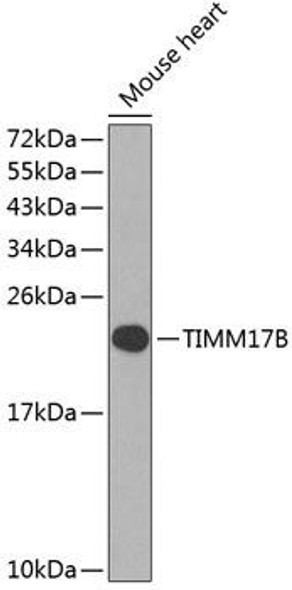 Cell Biology Antibodies 12 Anti-TIMM17B Antibody CAB8477