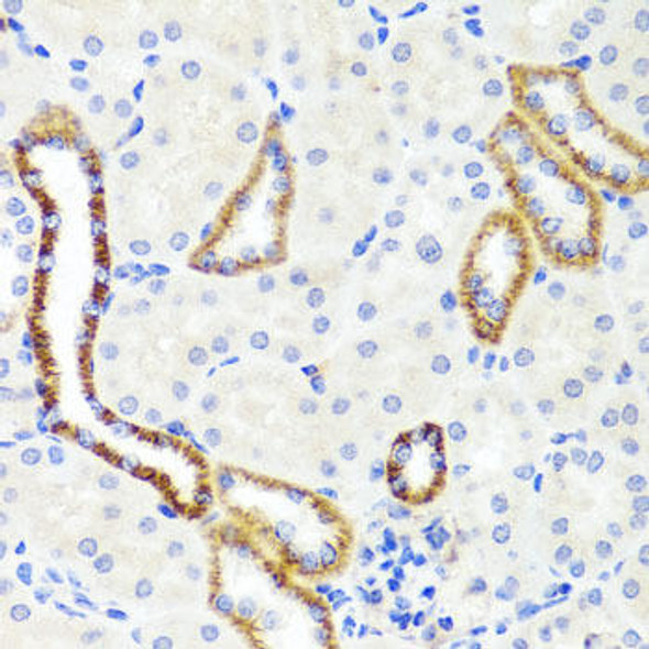 Cell Biology Antibodies 12 Anti-Synaptopodin Antibody CAB8484