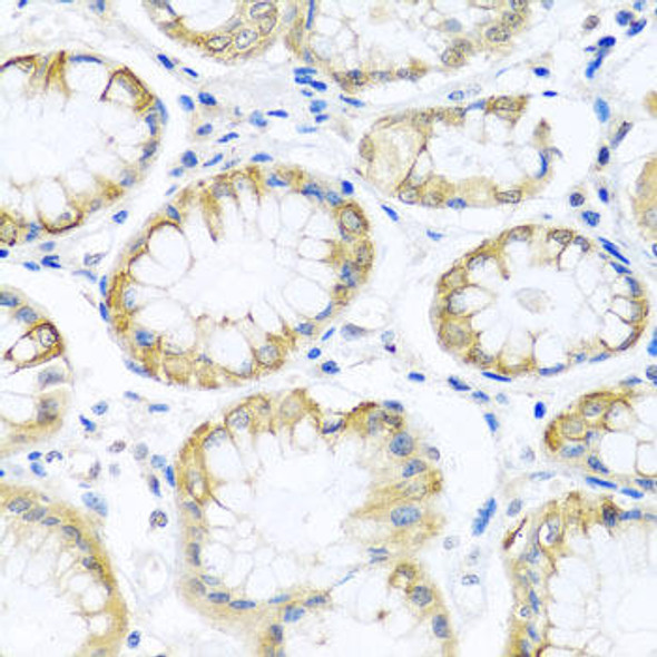 Cell Biology Antibodies 12 Anti-PCDHA12 Antibody CAB8501