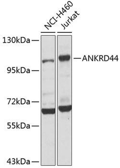 Cell Biology Antibodies 12 Anti-ANKRD44 Antibody CAB8521