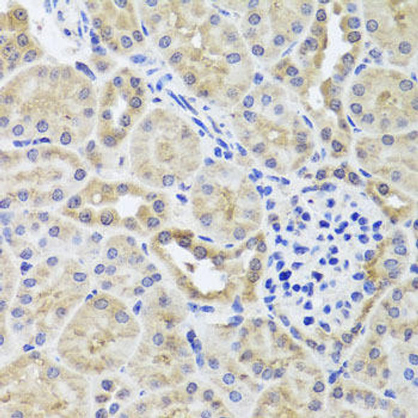 Cell Biology Antibodies 12 Anti-CGB7 Antibody CAB8522