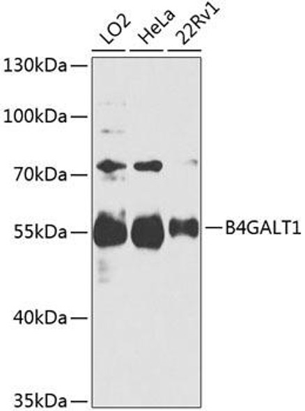 Cell Biology Antibodies 12 Anti-B4GALT1 Antibody CAB8546