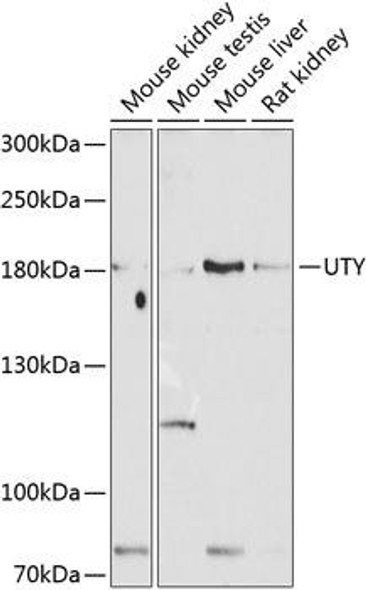 Cell Biology Antibodies 12 Anti-UTY Antibody CAB8563