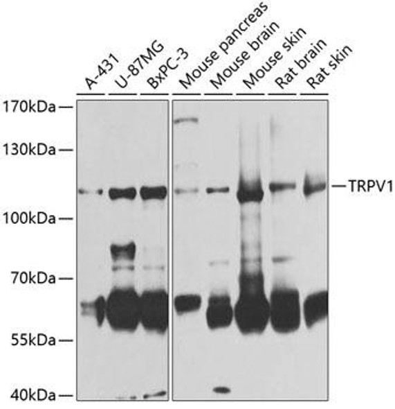 Cell Biology Antibodies 12 Anti-TRPV1 Antibody CAB8564