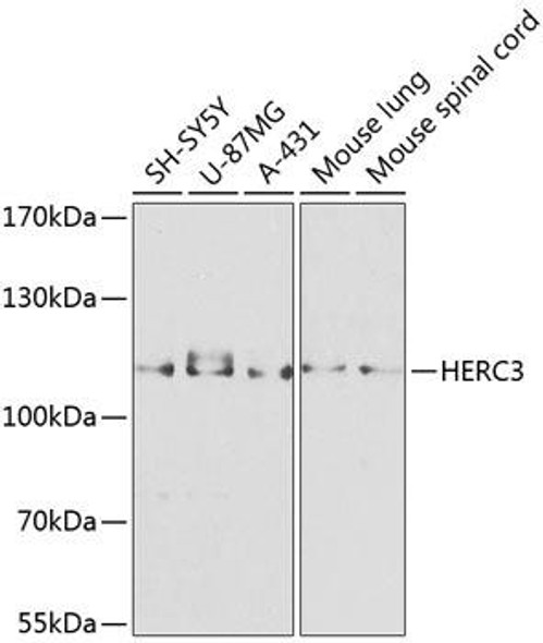 Signal Transduction Antibodies 3 Anti-HERC3 Antibody CAB8567