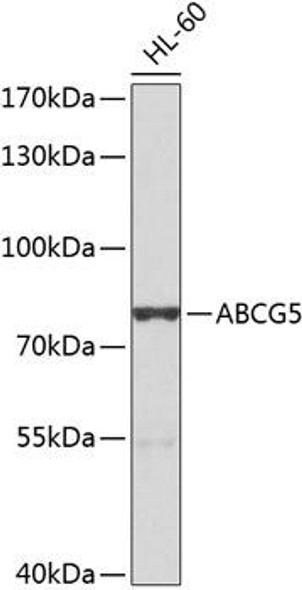 Cell Biology Antibodies 12 Anti-ABCG5 Antibody CAB8589