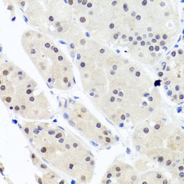 Cell Biology Antibodies 12 Anti-HNRNPCL1 Antibody CAB8606