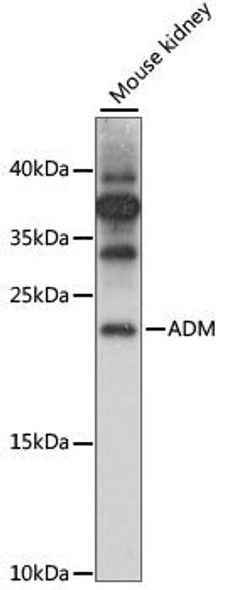 Neuroscience Anti-ADM Antibody CAB8659