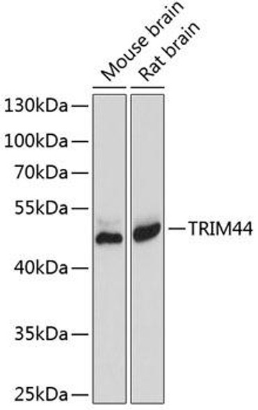 Cell Biology Antibodies 12 Anti-TRIM44 Antibody CAB8719