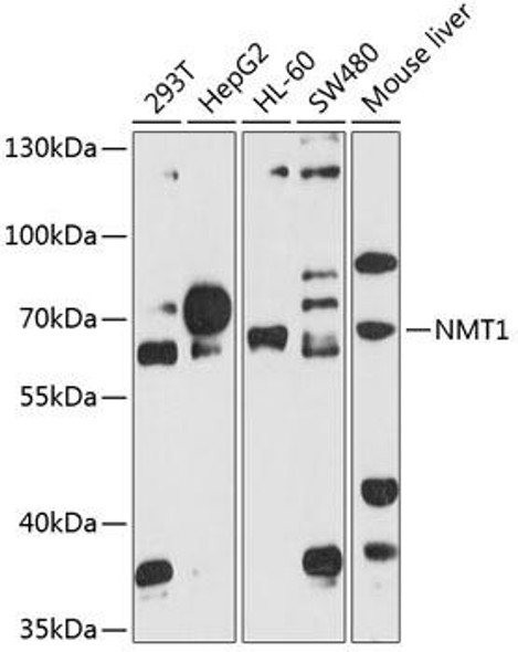Cell Biology Antibodies 12 Anti-NMT1 Antibody CAB8724