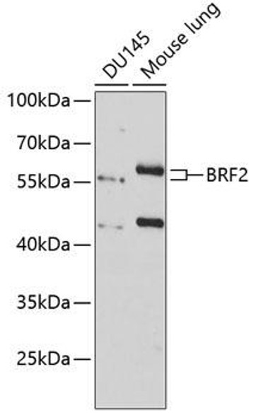 Metabolism Antibodies 3 Anti-BRF2 Antibody CAB8782