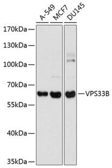 Cell Biology Antibodies 12 Anti-VPS33B Antibody CAB8799