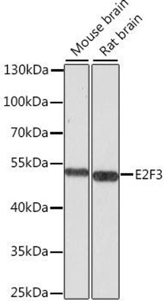 Cell Cycle Antibodies 2 Anti-E2F3 Antibody CAB8811