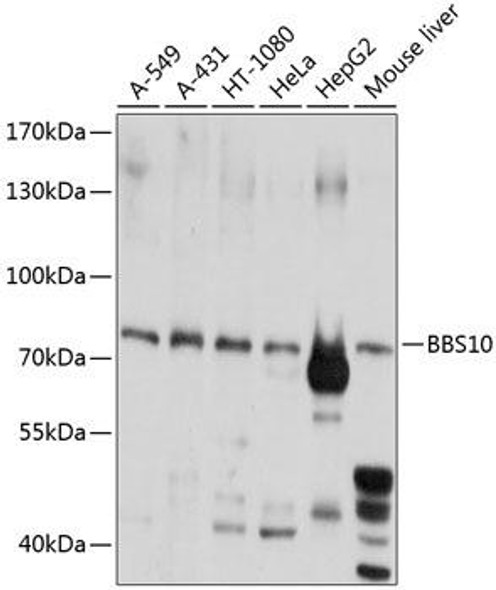 Signal Transduction Antibodies 3 Anti-BBS10 Antibody CAB8820