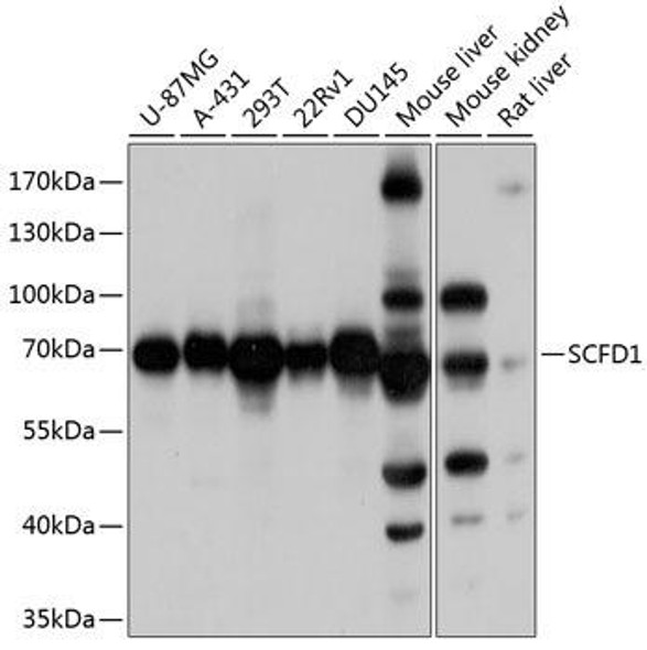 Cell Biology Antibodies 12 Anti-SCFD1 Antibody CAB8835