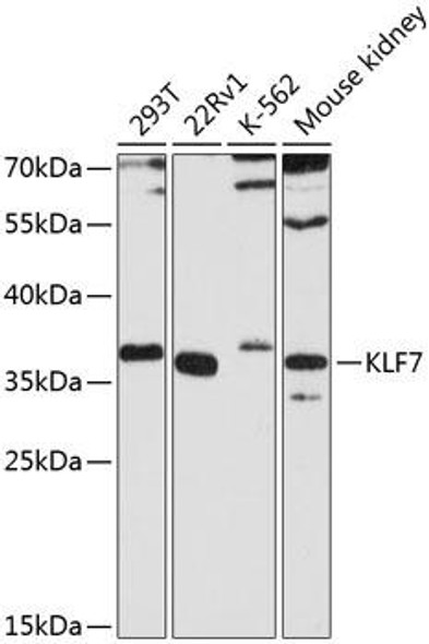 Epigenetics and Nuclear Signaling Antibodies 4 Anti-KLF7 Antibody CAB8879
