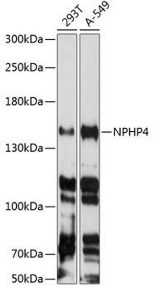 Cell Biology Antibodies 12 Anti-NPHP4 Antibody CAB8934