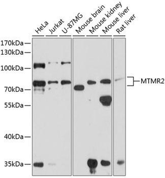 Metabolism Antibodies 3 Anti-MTMR2 Antibody CAB8993