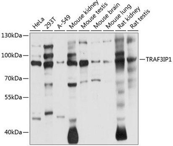 Cell Biology Antibodies 12 Anti-TRAF3IP1 Antibody CAB8997