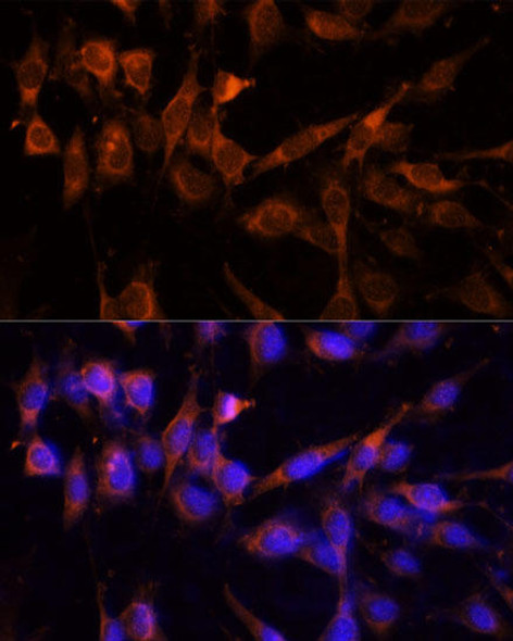 Signal Transduction Antibodies 3 Anti-YWHAH Antibody CAB9079