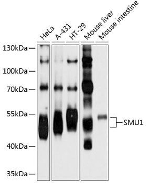 Immunology Antibodies 3 Anti-SMU1 Antibody CAB9110