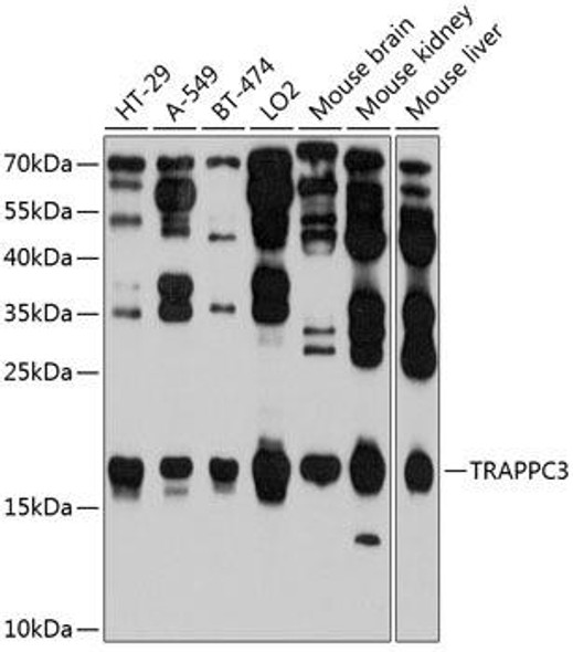 Cell Biology Antibodies 12 Anti-TRAPPC3 Antibody CAB9113
