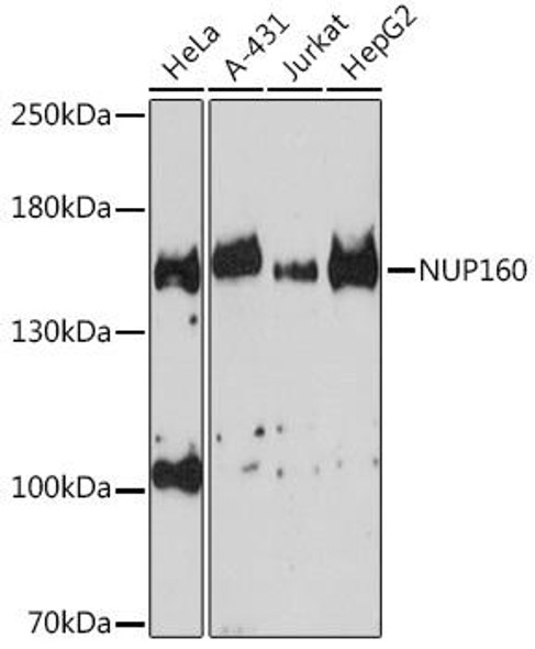 Epigenetics and Nuclear Signaling Antibodies 4 Anti-NUP160 Antibody CAB9161