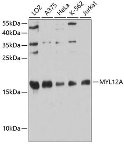 Cell Biology Antibodies 12 Anti-MYL12A Antibody CAB9176