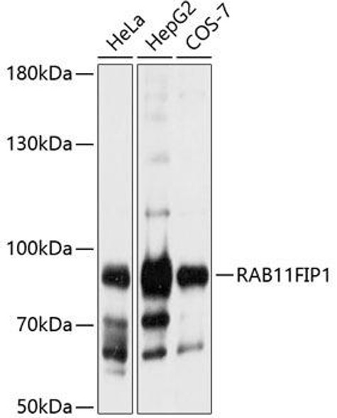 Cell Biology Antibodies 12 Anti-RAB11FIP1 Antibody CAB9215