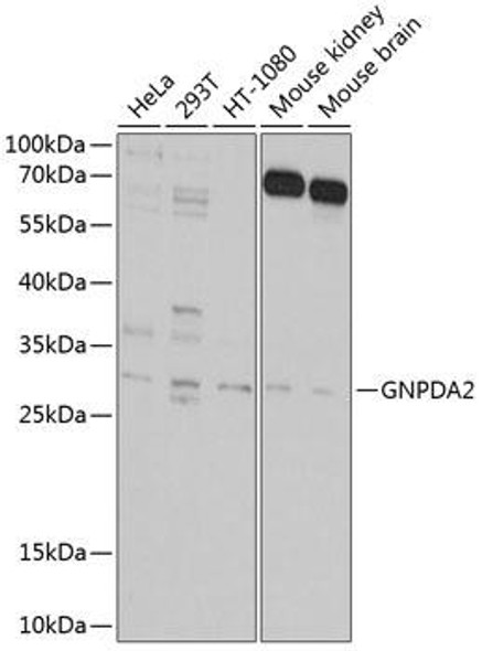 Metabolism Antibodies 3 Anti-GNPDA2 Antibody CAB9245