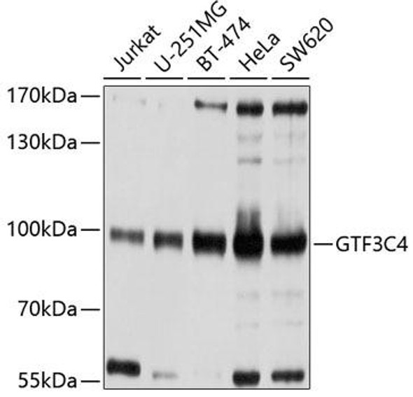 Epigenetics and Nuclear Signaling Antibodies 4 Anti-GTF3C4 Antibody CAB9287