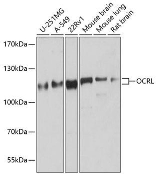 Cell Biology Antibodies 12 Anti-OCRL Antibody CAB9290