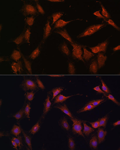 Cell Biology Antibodies 12 Anti-PFKFB2 Antibody CAB9311