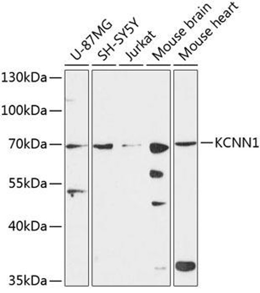 Signal Transduction Antibodies 3 Anti-KCNN1 Antibody CAB9322