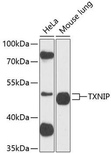 Cell Cycle Antibodies 2 Anti-TXNIP Antibody CAB9342