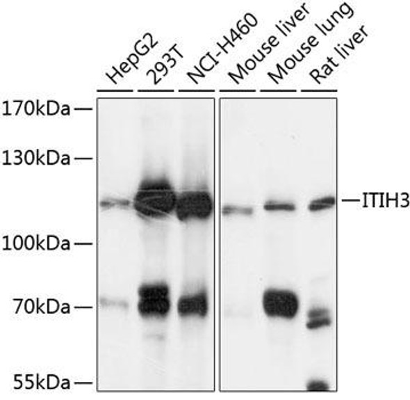 Signal Transduction Antibodies 3 Anti-ITIH3 Antibody CAB9459