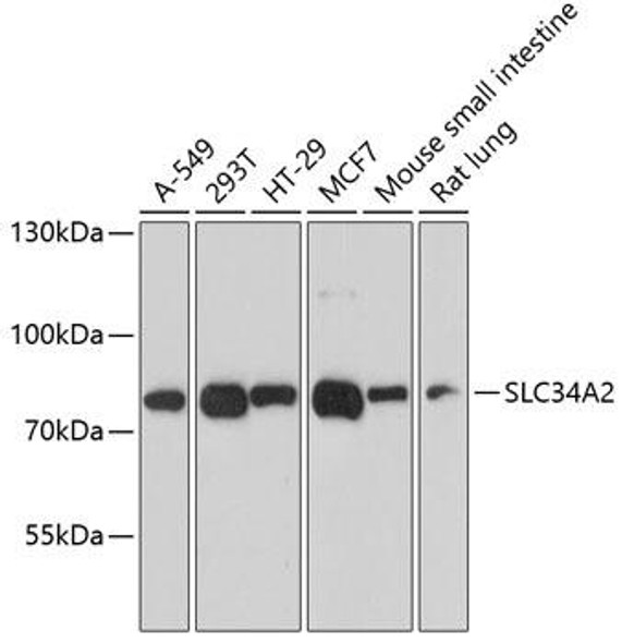 Signal Transduction Antibodies 3 Anti-SLC34A2 Antibody CAB9460