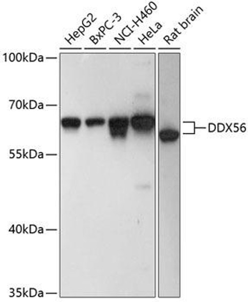 Cell Biology Antibodies 12 Anti-DDX56 Antibody CAB9487