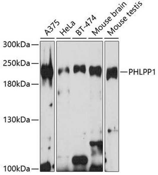 Cell Death Antibodies 2 Anti-PHLPP1 Antibody CAB9542