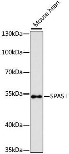Cell Cycle Antibodies 2 Anti-SPAST Antibody CAB9543